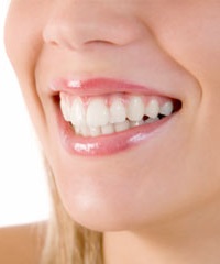 системы кабинетного отбеливания зубов