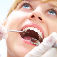 подготовка зубов к процедуре отбеливания