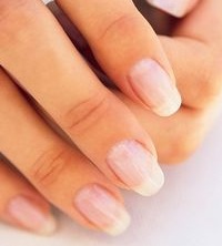 белые пятна на ногтях рук
