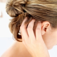 Псориаз на голове: как жить с этим заболеванием? 