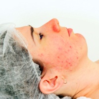 красные точки на коже аллергия осложнения