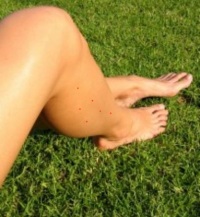 мелкие красные точки на ногах