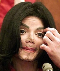 неудачные пластические операции Майкл Джексон