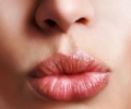 Сухие губы: увлажнение и питание