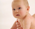 Атопический дерматит у младенцев – мучительный диатез