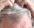 Псориаз волосистой части головы: не приговор, но руководство к действию