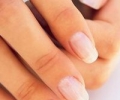 Белые пятна на ногтях рук: нужно искать причину