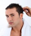 выпадение волос мужчин